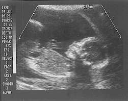 Ultrasound July 25
